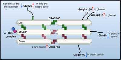 Alterations of Golgi Structural Proteins and Glycosylation Defects in Cancer